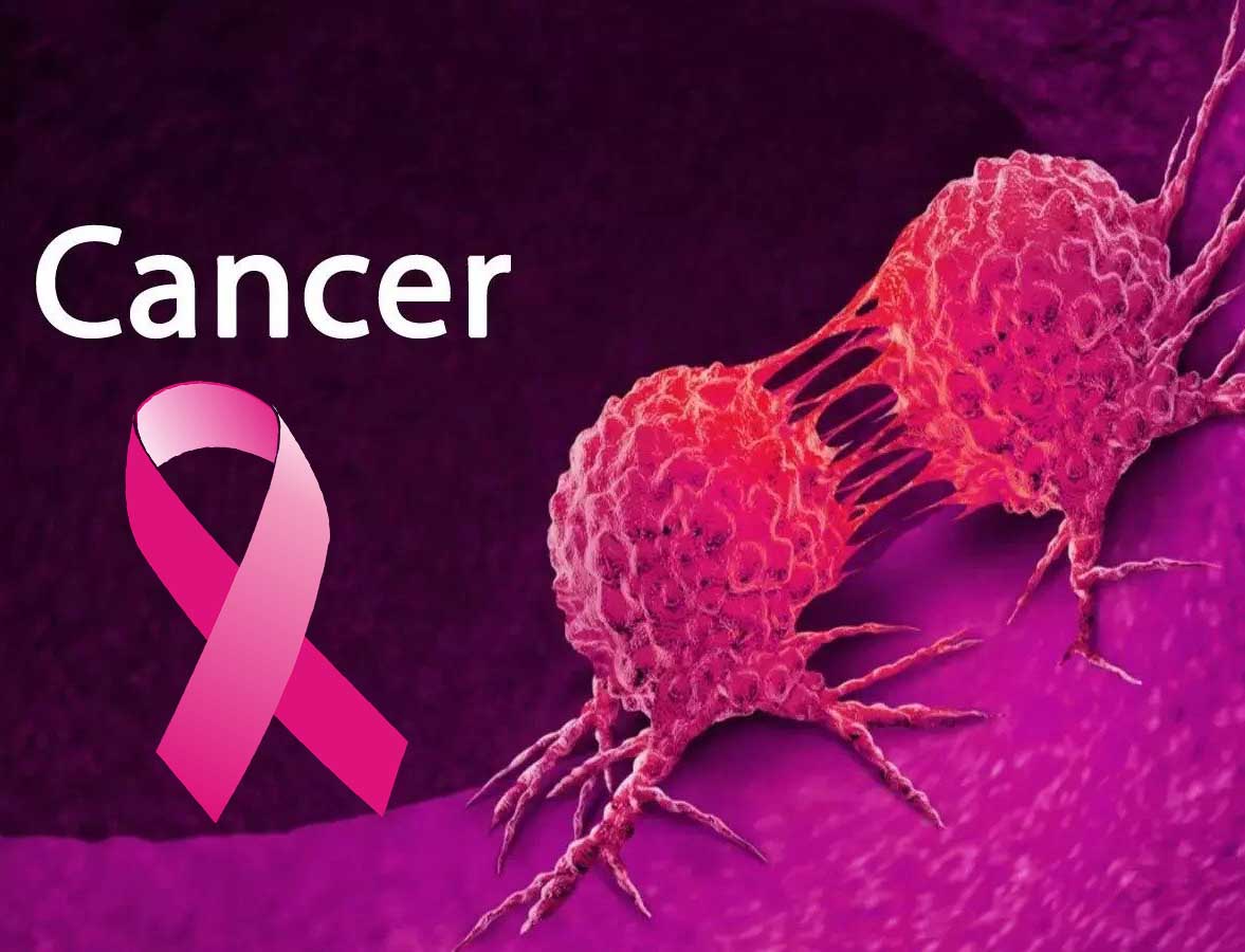 STUDIU Înregistrăm o creștere alarmantă a numărului de cazuri de cancer la persoanele sub 50 de ani